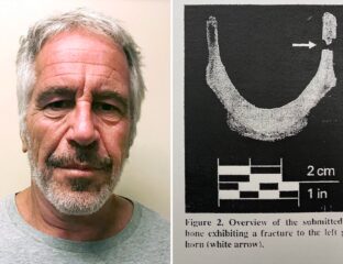 Did Jeffrey Epstein really kill himself? Let’s take a look at the autopsy reports and see what’s similar and what’s different.