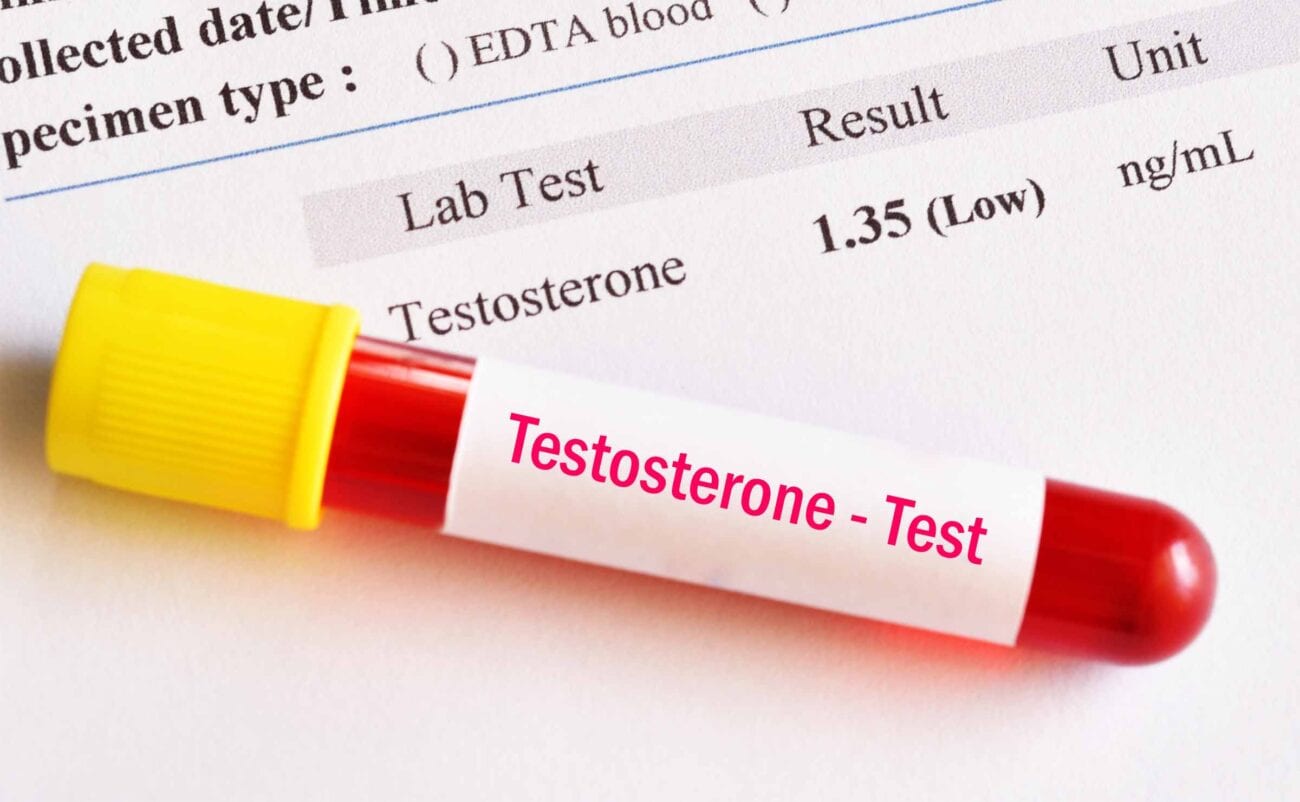 What Is The Name Of The Test For Testosterone