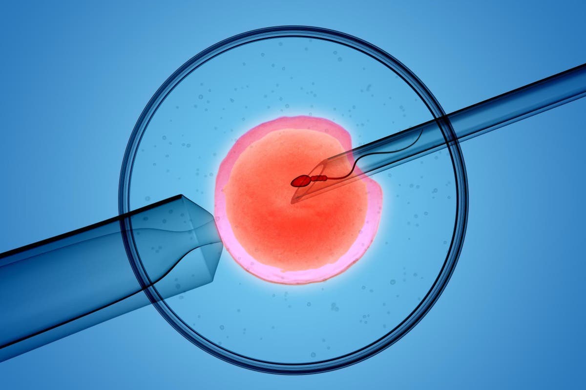 IVF is the most well-known assisted reproductive method. How does IVF work? Will it work on a woman who is not a candidate?