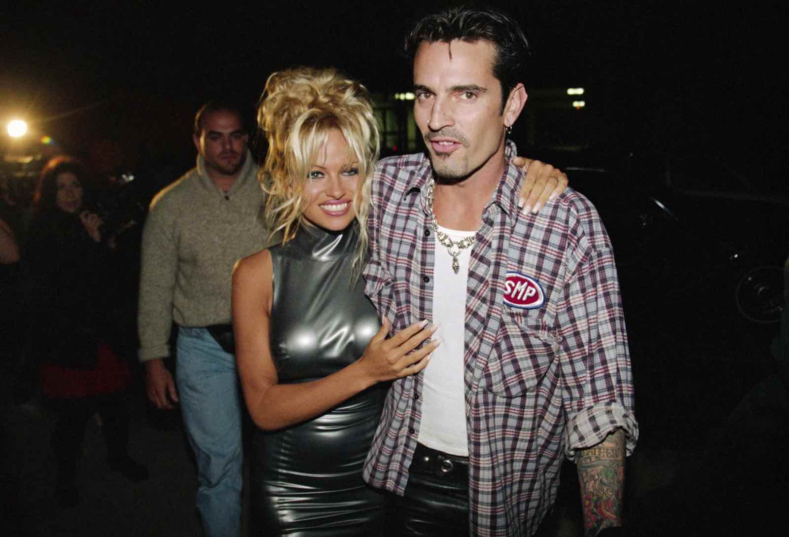 Pamela Anderson Getting Her Barbed Wire Tattoo Removed  ETCanadacom