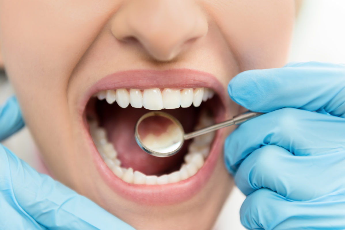 Do you require dental restoration? Most individuals require teeth restoration at some point in life. Here's a guide to finding the best dental services.