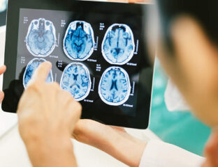 The advancement of medical imaging services has given us more knowledge about the human body. Here's everything you need to know.