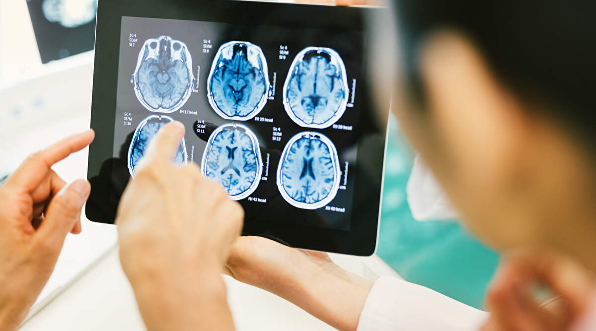 The advancement of medical imaging services has given us more knowledge about the human body. Here's everything you need to know.