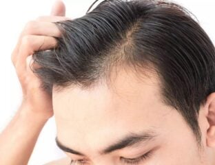 A hair transplant surgery is not a very hectic procedure especially when you go for well-qualified doctors.