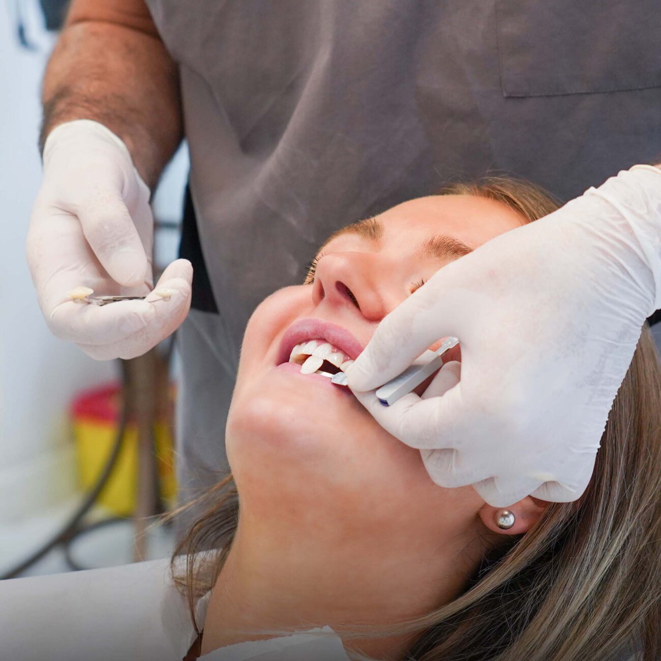 The first question many people ask about cosmetic procedures: how much do dental veneers cost in Turkey compared with the UK, Germany, and the US..
