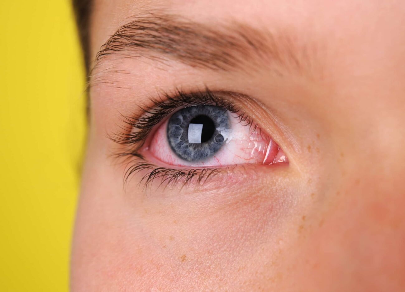 Knowing when to attend the doctor is hard. Should you visit the ophthalmologist? We'll show you a list of reasons that indicate the possibilities.
