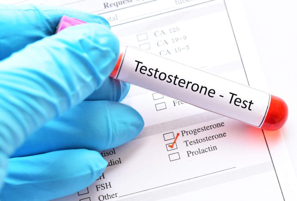 Testosterone is the most common male hormone in men. How can actors increase their testosterone levels?