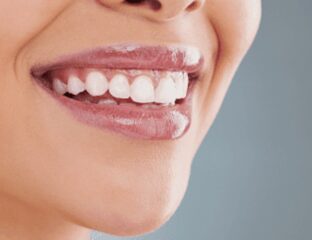 So, you have finally got the dental implants? Congratulations! Here's how you can keep them looking great.