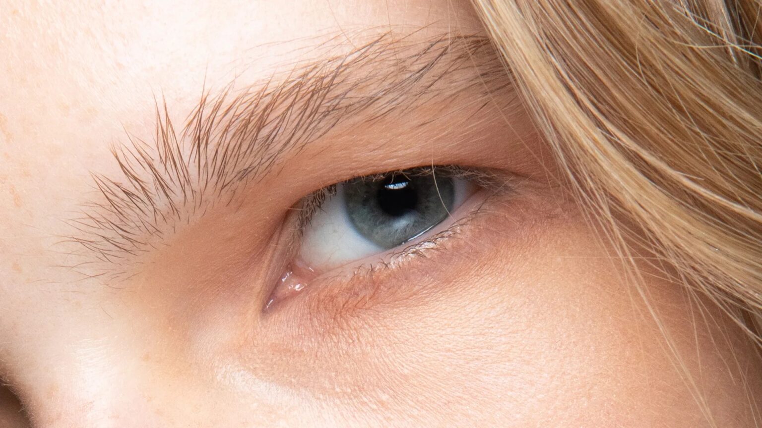 From simple home remedies to topical treatments and surgery, there are many options available. Here's how to treat under eye bags.