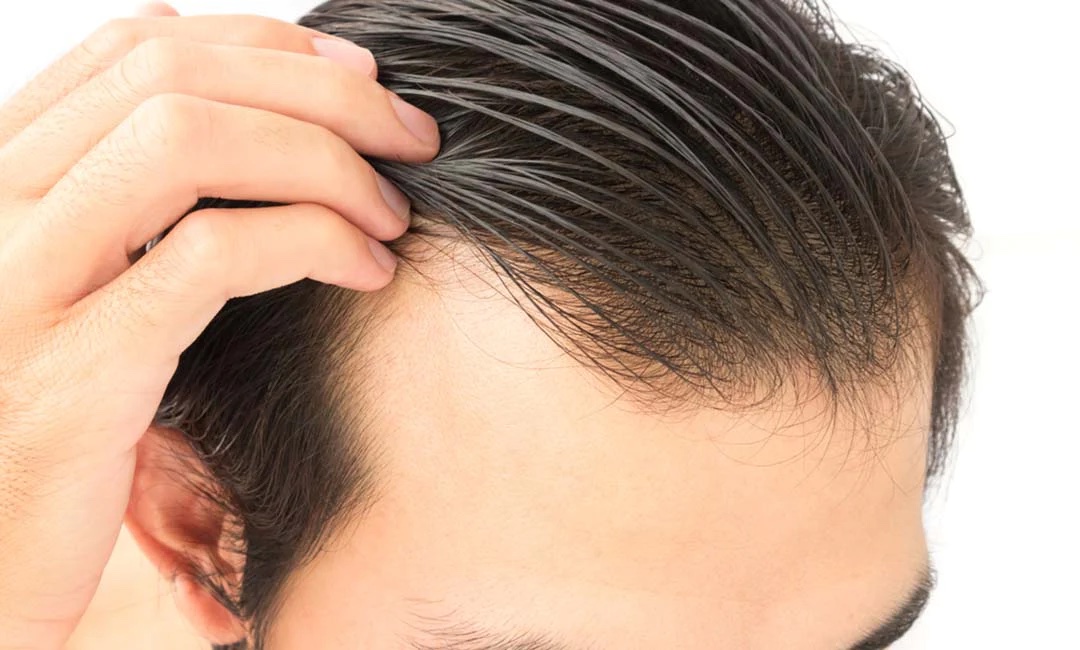 Men with fine hair often face the challenge of maintaining volume and thickness. Here are the best products for men.