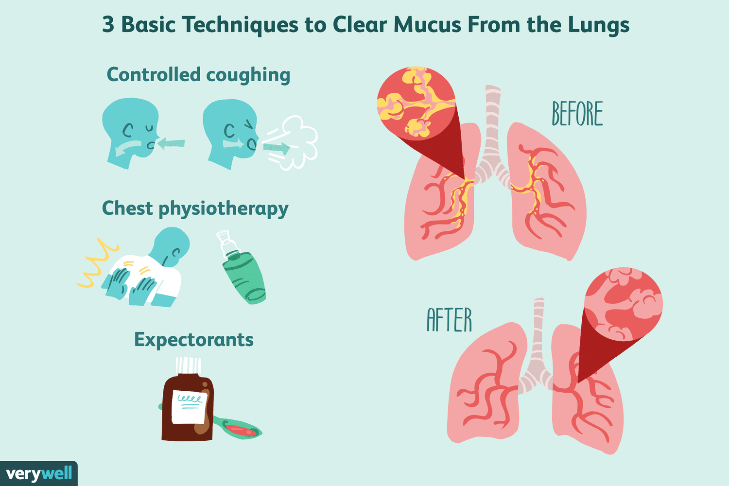 Cleaning Mucus in the Lungs Naturally