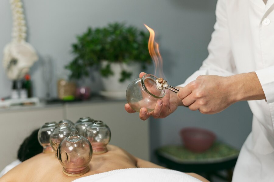 Cupping in Lindenhurst: A Basic Manual for Ancient Healing
